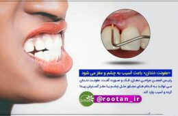 عفونت دندان باعث آسیب به چشم