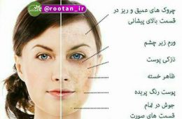 تاثیر کمبود پنج ماده غذایی ب