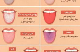 با توجه به رنگ زبان میتونیم به بیماریهای مختلف پی ببریم