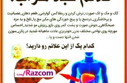 ۳۰ درصد ایرانی ها درجاتی از کب