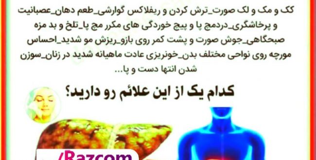 ۳۰ درصد ایرانی ها درجاتی از کب