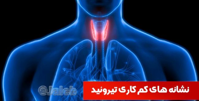 شاید برایتان عجیب باشد اما فرا