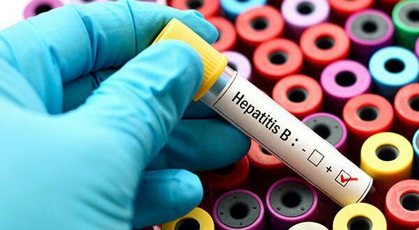 همه آنچه که درباره هپاتیت B باید بدانیم